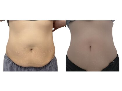 ルナ(LUNA)の写真