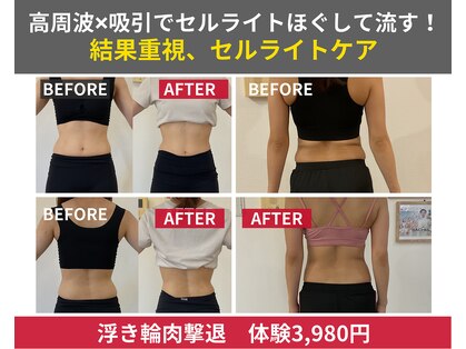 リベア(REBEA)の写真