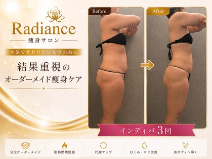 レディエンス(Radiance)の写真