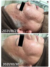 ビエル(Bielle)/70代まで何もしてこなかったけど