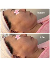 ルミナス(Luminous)/美肌＆小顔