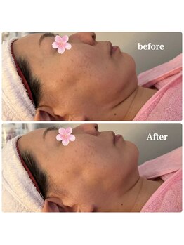 ルミナス(Luminous)/美肌＆小顔