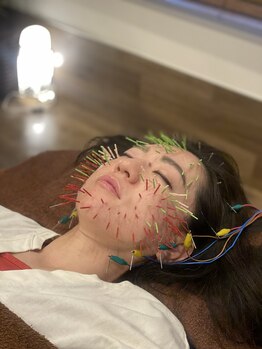 長寿鍼灸院 長寿整骨院/究極のシャワー美容鍼★200本