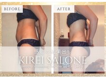 キレイサローネ 池袋東口店(KIREI SALONE)