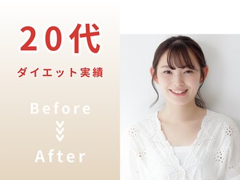 スリール(Sourire)/20代ダイエット Before/After