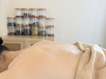 アオイ(Aoi)/肩こり、腰痛、疲労に全身鍼