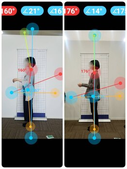 若松整体院若林区院/矯正ビフォーアフター☆