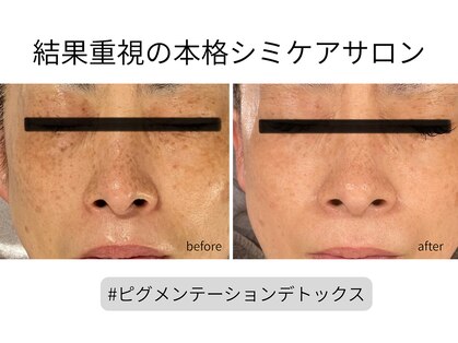 ブリノス(BLINOSS)の写真