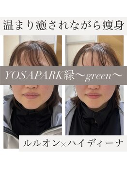 ヨサパーク グリーン(YOSA PARK 緑 green)/水素包まれコース1回の変化