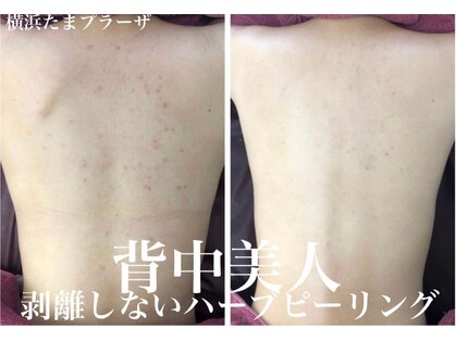 リリアーナ(LILIANA)の写真