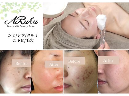 アルル(ARuru)の写真