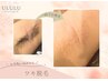 【気軽に始められる】 ワキ脱毛¥5,500→