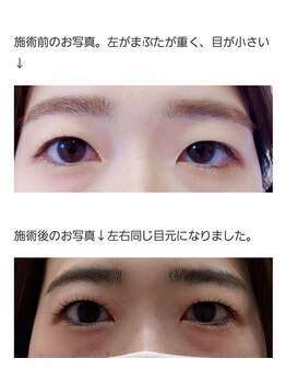 アロマスイーツ(AromaSweets)/まつげパーマ/まつ毛パーマ