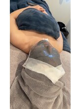 ミヨン(Miyong)/volayonアンチプレシオネス管理