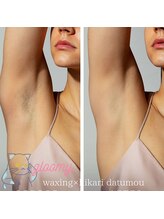 グルーミー(gloomy)/ワックス初心者むけ！両脇脱毛！