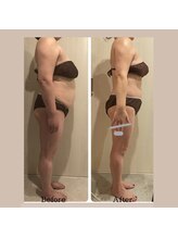 ナナイロ(nanairo)/筋膜リリース5カ月の変化