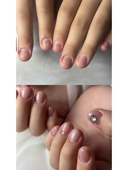 エンチューン(en.tune)/大人気☆深爪矯正＋ワンカラー