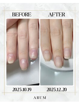 Luxury escape 剥離しかけた爪