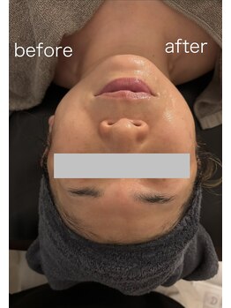 ココ アンジュ(COCO ANGE)/