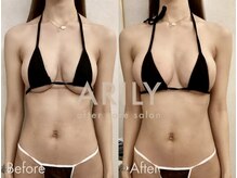 アリリィ(ARILY)/インディバダウンタイム/表参道