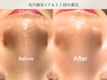 フェイシャルサロン ベルダ(BELDA)