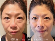 グランディールスイート(GRANDIR suite)の雰囲気（コルギ2回で劇的変化！回数を重ねる毎にリフトアップと肌質改善）