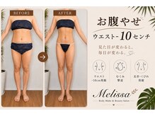 メリッサ(Melissa)の雰囲気（【光脱毛/シュガーリング】食べられるペーストで綺麗なお肌変身）