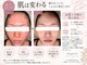 ミニョン(mignon)の写真
