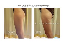 ディアレスト(Dearest)/ハイフ2部位＆アロママッサージ