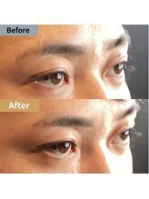 眉毛ハウス 吉祥寺店(眉毛HOUSE)/お客様の施術例(吉祥寺/東京)