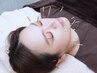 【再来】美容鍼灸