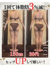 アーユルヴェーダアンドアロマエステ アユス(AYUS)/1回で体脂肪ー３％