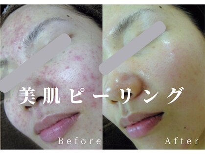綺麗サロン 脱毛アンドフェイシャル ジュエル(Jewel)の写真