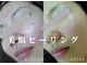 綺麗サロン 脱毛アンドフェイシャル ジュエル(Jewel)の写真