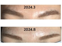 ダブルオー 銀座(00)/美容電気脱毛/眉デザイン