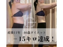エルバード