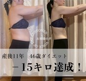 エルバード