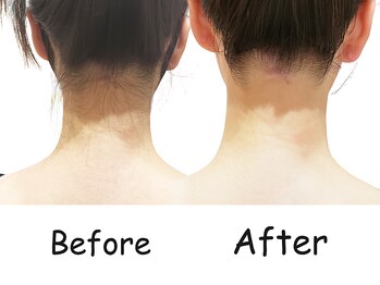 シエル(Siele)/【広島】ブライダルシェービング