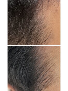 リツイート(ReTweet)/医療提携 六か月服用