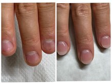 ブルームーンネイルズ(BLOOMOON.nails)