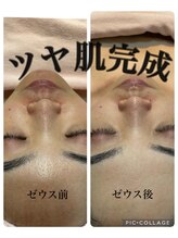 ビューティフェイス ビューティアイラッシュ 岡山天満屋店(BeautyFace Beautyeyelash)/ゼウス新登場【岡山】