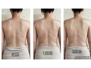 ラレコルト/ビフォーアフター