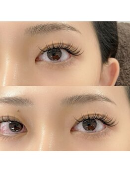 シェリル 国分寺(Cherilu)/エリア最先端！バインドロック