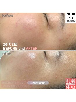 アンナカルナ(AnnaCarna)/透明感のある素肌美へ導きます