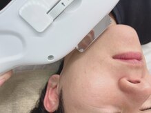 カラー(CALLA)/メンズ脱毛