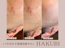 ハクビ(HAKUBI)