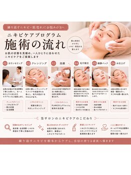 ネオ 熊本玉名(neo)/ニキビケアプログラム