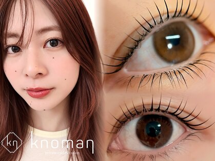 ノマン(Knoman)の写真