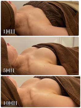 ビジョイ(Bejoy)/バストコース　ビフォーアフター