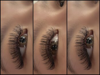 セサニー(SE SUNNY)/下　J/Cカール　7m～10m